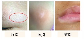 脸上长白斑?.jpg